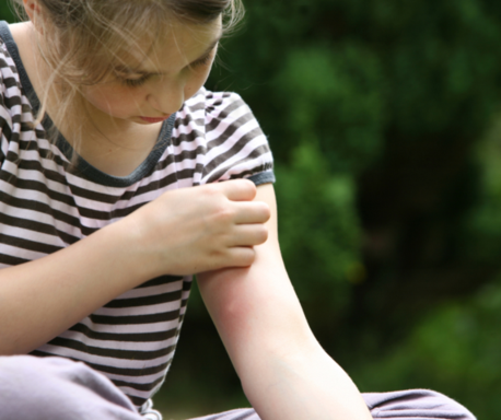 Insect bites and stings are common concerns.